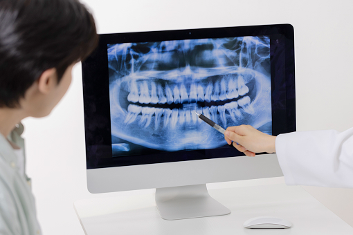 레더스스마일치과 치아교정 장점