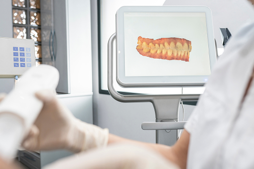 레더스스마일치과 치아교정 장점3