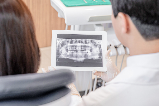 레더스스마일치과 치아교정 장점5