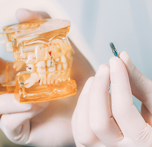 신경치료(근관치료)